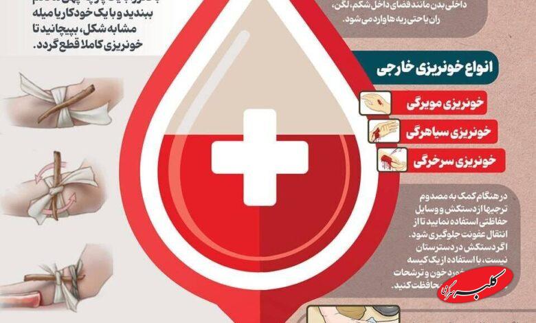ببینید: چطور خونریزی را کنترل کنیم؟