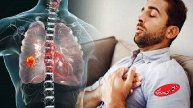 راهنمای حیاتی نجات؛ چگونه در شرایط بحرانی حمله آسم را مهار کنیم؟