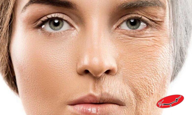چگونه پوستمان را جوان نگه داریم؟