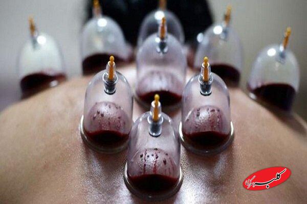 حجامت توسط افراد غیر متخصص خطرناک است