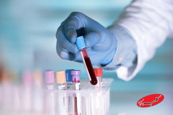 ۳۳۸ روز تاخیر در پاسخ دهی به نمونه های آزمایشگاهی