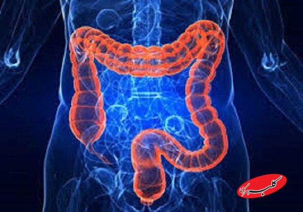 ارتباط مراحل اولیه بیماری التهابی روده با تغییرات در باکتریهای روده