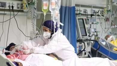 سکته مغزی