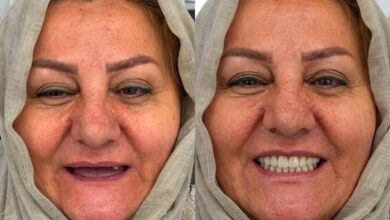 اوردنچر فول