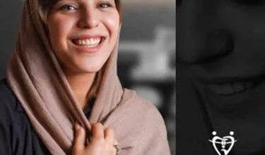 نمونه عکس ارتودنسی نامرئی کلینیک دندانپزشکی دکتر محمدرضا بدیعی