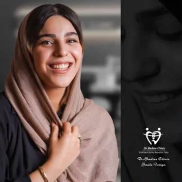 نمونه عکس ارتودنسی نامرئی کلینیک دندانپزشکی دکتر محمدرضا بدیعی